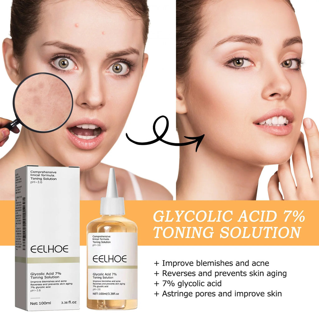 Solución tonificante de ácido glicólico al 7% para el acné, efecto lifting, reafirmante, antiarrugas, piel radiante, cuidado facial, tónico de ácido glicólico